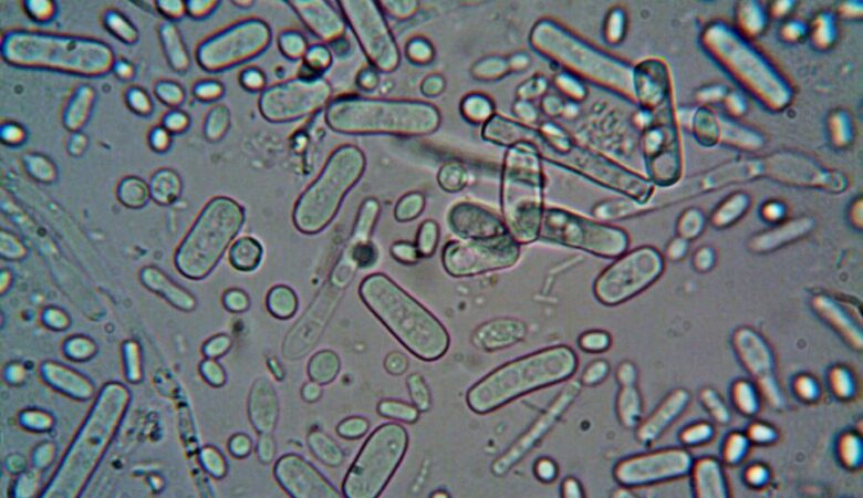 Hai un biofilm vescicale? Fai il test!