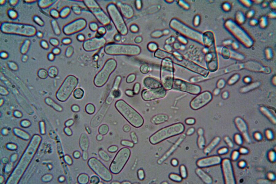 Ho un biofilm vescicale?