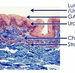 Anatomia delle vie urinarie basse e GAG